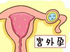 深圳52岁助孕机构-试管婴儿移植后也可能发生宫外孕，这些是宫外孕的主要原因